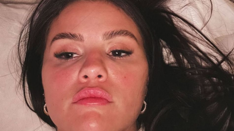 ¿Qué enfermedad tiene Selena Gomez? La historia completa detrás de su salud y lucha personal 10 imagen 2026 04 04 151348615